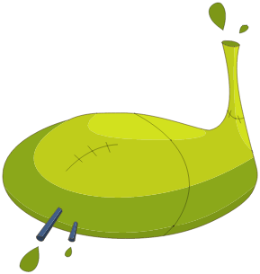 Estomac de Prespic
