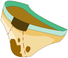 Culotte à l\'envers du Roissingue