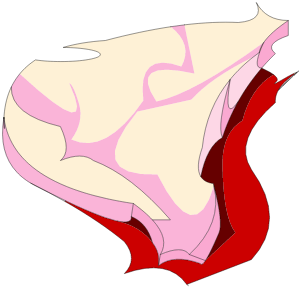 Bifstèque de Dragoviande ****